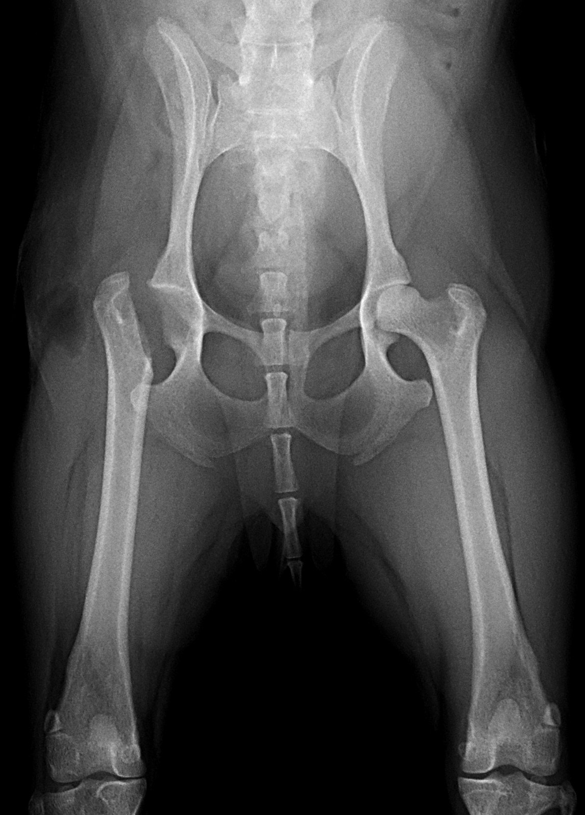 大腿骨頭壊死症のレントゲン